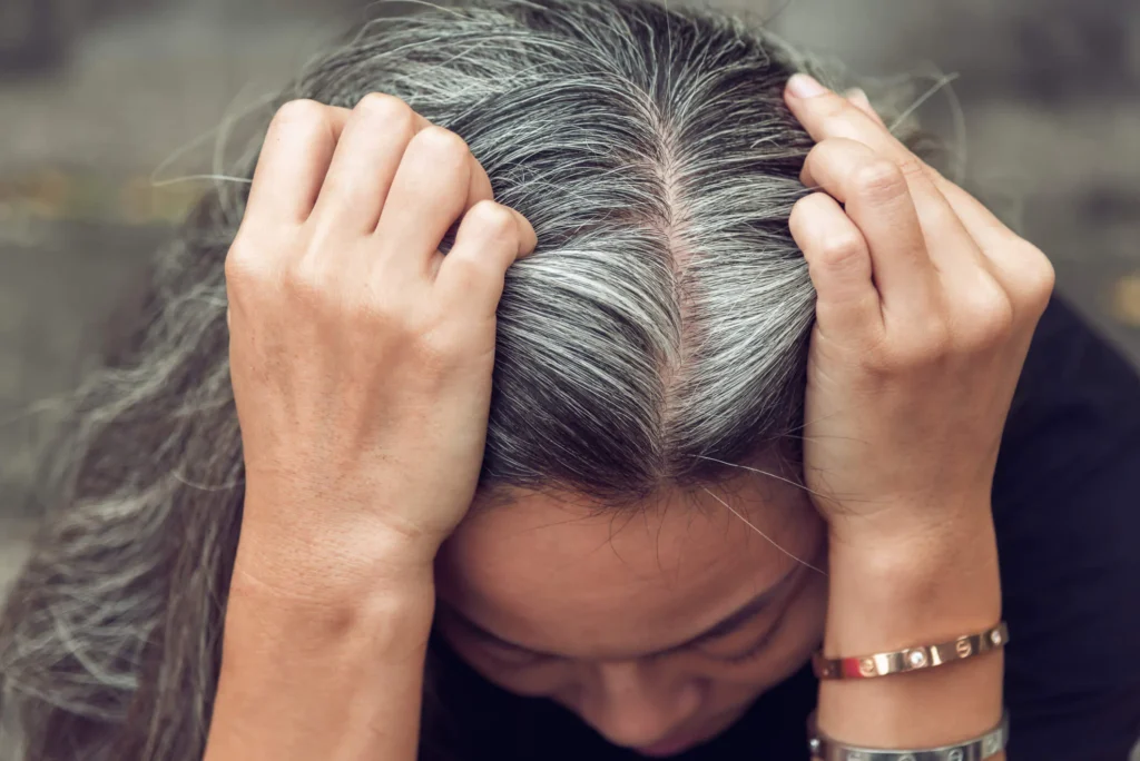 Razones por las que podrían salirte canas a temprana edad